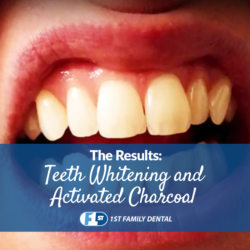 DIY Teeth Whitening with Activated Charcoal 1st Family Dental