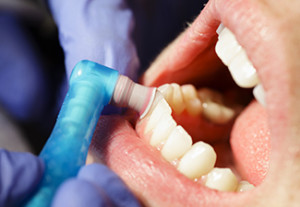 Regular Dental Cleanings in Chicago, IL