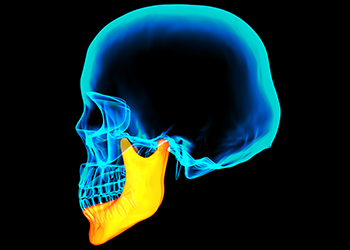 TMJ Disorders Joint Jaw Pain