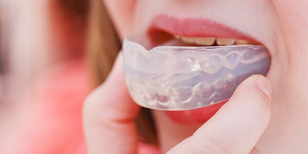 Mouthguards - 1st Family Dental