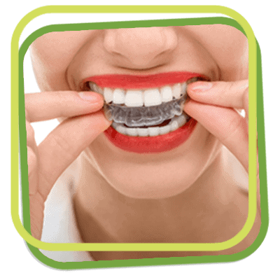 How to use Elastics - Orthodontic Appliances - Doctor Emma