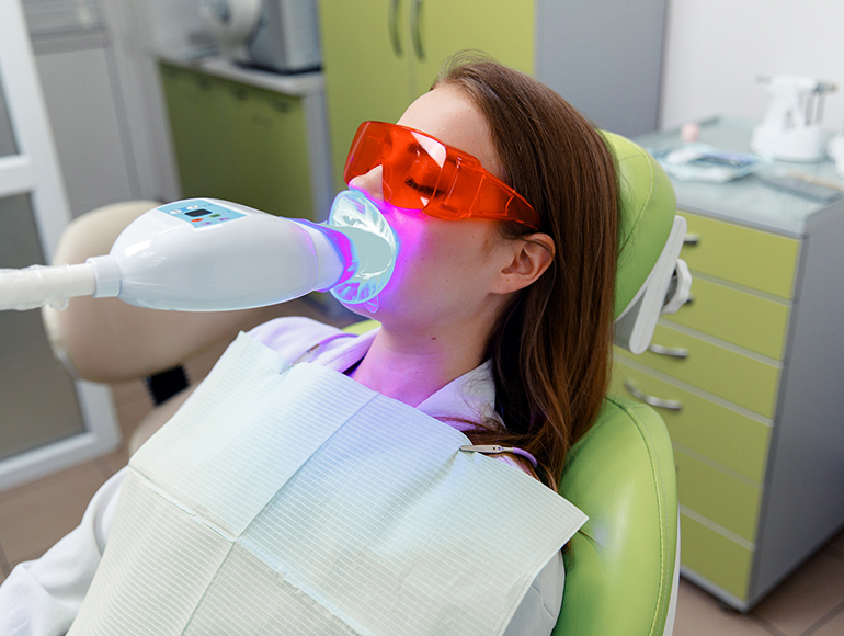 Teeth Whitening