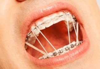 orthodontic services - temporary anchorage