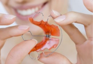 retainer-your perfect smile